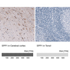 Anti-SPP1 Antibody