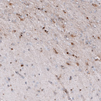 Immunohistochemical staining of human cerebral cortex (Alzheimer disease) shows moderate cytoplasmic positivity in microglia.