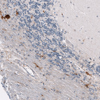 Immunohistochemical staining of human cerebellum shows moderate cytoplasmic positivity in microglia.