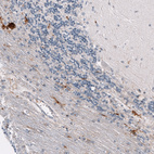 Anti-SPP1 Antibody