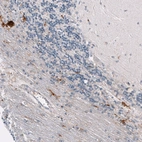 Immunohistochemical staining of human cerebellum shows moderate cytoplasmic positivity in microglia.