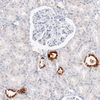 Immunohistochemical staining of human kidney shows strong cytoplasmic positivity in cells in distal tubules.
