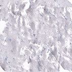Immunohistochemical staining of human skeletal muscle shows no positivity in myocytes as expected.