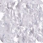 Immunohistochemical staining of human skeletal muscle shows no positivity in myocytes as expected.