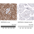 Anti-SERPINA3 Antibody
