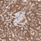 Anti-SERPINA3 Antibody