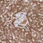 Immunohistochemical staining of human liver shows strong cytoplasmic positivity in hepatocytes.