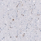 Immunohistochemical staining of human cerebral cortex shows cytoplasmic and nuclear positivity in a subset of glial cells.