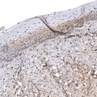 Immunohistochemical staining of human uterine cervix shows moderate cytoplasmic positivity in squamous epithelial cells.