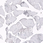 Immunohistochemical staining of human skeletal muscle shows no positivity in myocytes as expected.