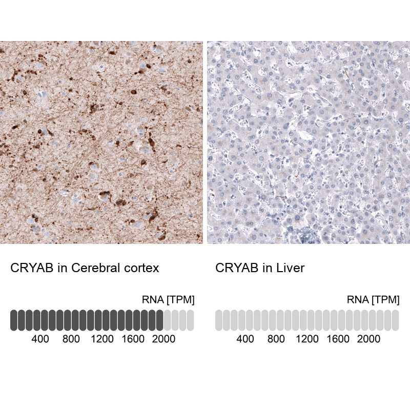 Mouse Monoclonal Anti-CRYAB Antibody - Buy for research - Highly ...
