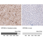 Anti-CRYAB Antibody