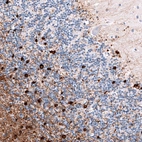 Immunohistochemical staining of human cerebellum shows strong cytoplasmic positivity in oligodendrocytes.