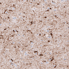 Immunohistochemical staining of human cerebral cortex shows strong cytoplasmic positivity in oligodendrocytes.