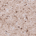 Immunohistochemical staining of human cerebral cortex shows strong cytoplasmic positivity in oligodendrocytes.
