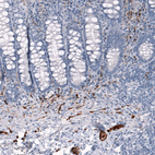 Immunohistochemical staining of human rectum shows strong cytoplasmic positivity in peripheral ganglia and nerves.