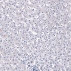 Immunohistochemical staining of human liver shows no positivity in hepatocytes as expected.