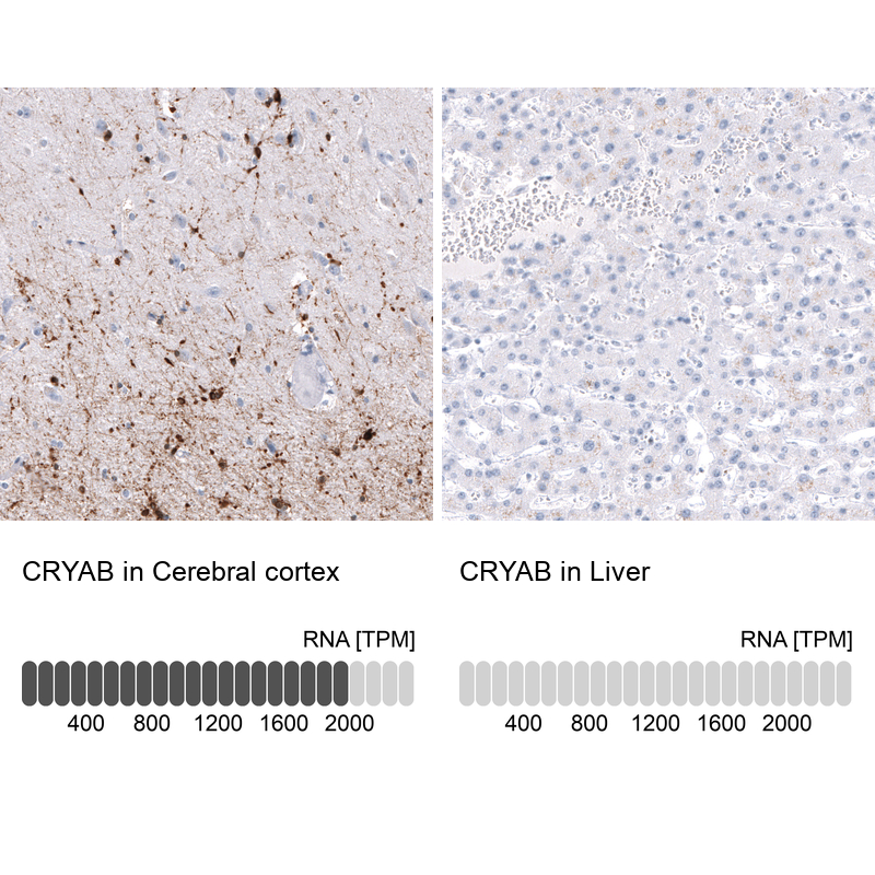 Anti-CRYAB Antibody