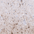Immunohistochemical staining of human cerebral cortex shows strong cytoplasmic positivity in oligodendrocytes.