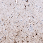 Immunohistochemical staining of human cerebral cortex shows strong cytoplasmic positivity in oligodendrocytes.