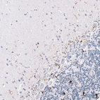 Immunohistochemical staining of human cerebellum shows strong cytoplasmic positivity in oligodendrocytes.