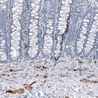 Immunohistochemical staining of human rectum shows strong cytoplasmic positivity in peripheral ganglia and nerves.