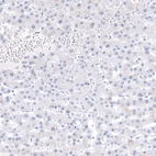 Immunohistochemical staining of human liver shows no positivity in hepatocytes as expected.