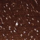 Immunohistochemical staining of human cerebral cortex shows strong positivity in neuronal processes in neuropil.