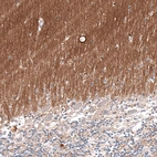 Immunohistochemical staining of human cerebellum shows moderate positivity in neuropil.