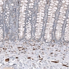 Immunohistochemical staining of human rectum shows strong positivity in peripheral ganglia and nerves.