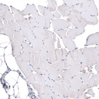 Anti-GAP43 Antibody