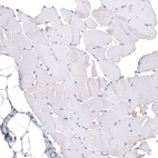 Immunohistochemical staining of human skeletal muscle shows no positivity in myocytes as expected.