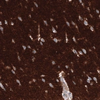 Immunohistochemical staining of human cerebral cortex shows strong positivity in neuronal processes in the neuropil.