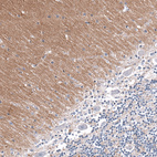 Immunohistochemical staining of human cerebellum shows moderate positivity in neuropil.