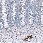 Immunohistochemical staining of human rectum shows strong positivity in peripheral ganglia and nerves.