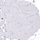 Immunohistochemical staining of human skeletal muscle shows no positivity in myocytes.