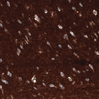 Immunohistochemical staining of human cerebral cortex shows strong positivity in neuronal processes in neuropil.