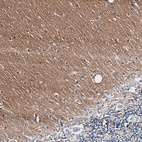 Anti-GAP43 Antibody