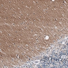 Immunohistochemical staining of human cerebellum shows moderate positivity in neuropil.