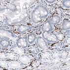 Immunohistochemical staining of human duodenum shows strong cytoplasmic positivity in peripheral nerves.