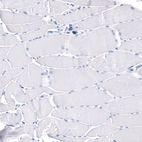 Immunohistochemical staining of human skeletal muscle shows no positivity in myocytes as expected.