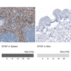 Anti-DYSF Antibody