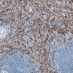 Anti-DYSF Antibody