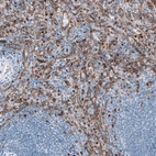 Immunohistochemical staining of human spleen shows moderate positivity in cells in red pulp.