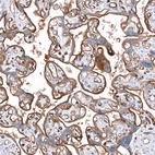 Immunohistochemical staining of human placenta shows moderate membranous positivity in trophoblastic cells.