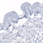 Immunohistochemical staining of human skin shows no positivity in keratinocytes as expected.