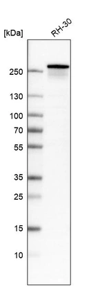 Western blot analysis in human cell line RH-30.