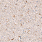 Anti-AIF1 Antibody