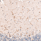 Immunohistochemical staining of human cerebellum shows moderate cytoplasmic positivity in microglia.