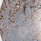 Immunohistochemical staining of human lymph node shows strong cytoplasmic positivity in non-germinal center cells.